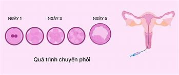 Quá Trình Ivf